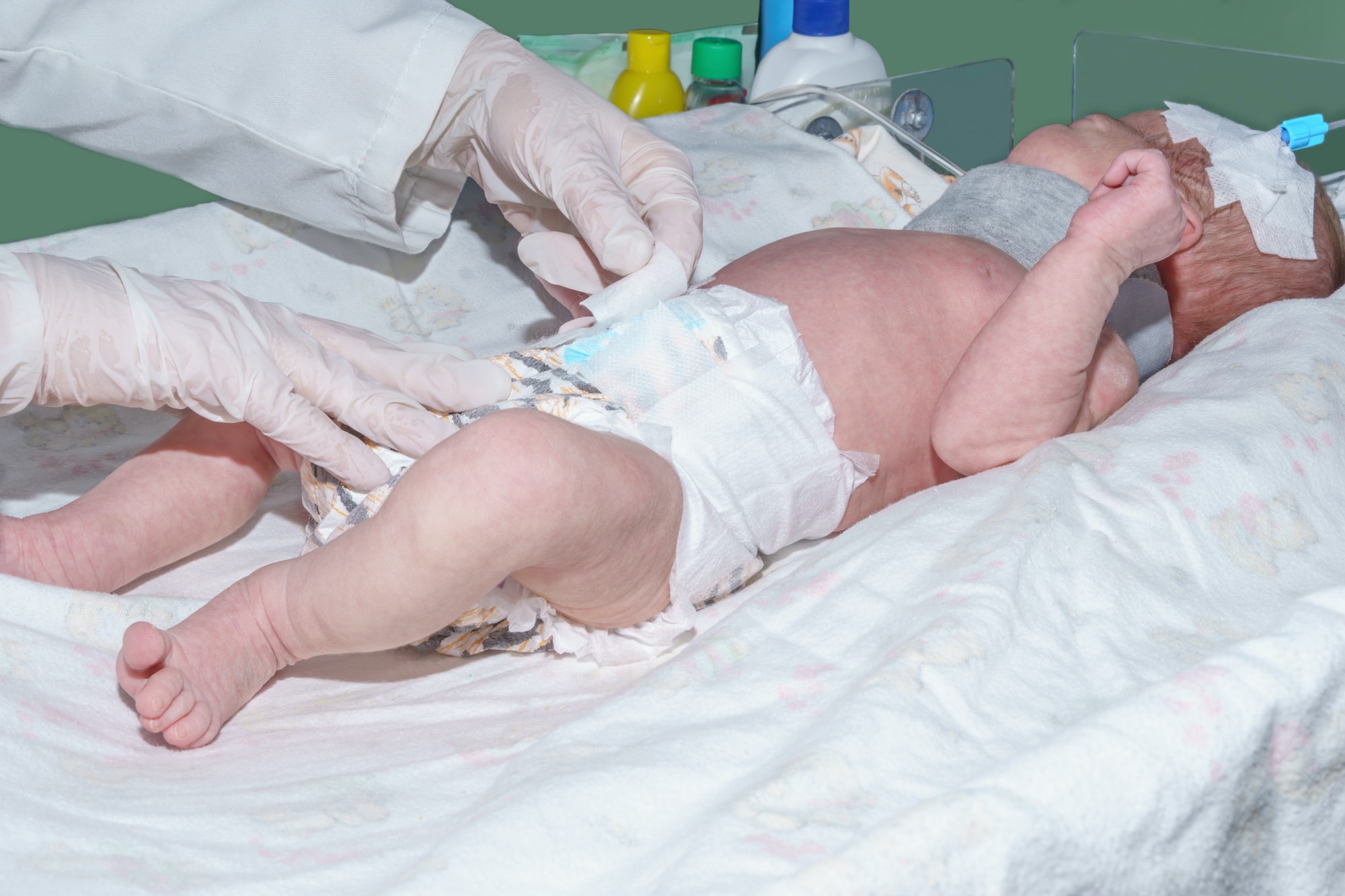 common birth injuries
