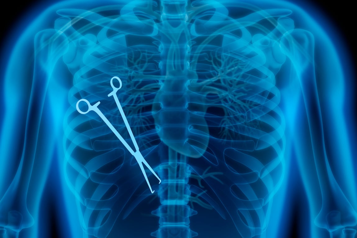 Understanding the 'Reasonable Person' Standard in Negligence