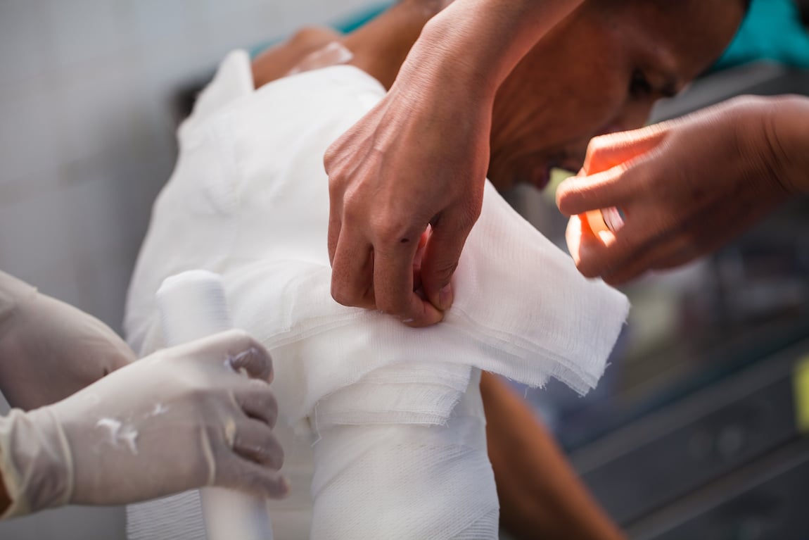 Long-Term Effects of Burn Injuries