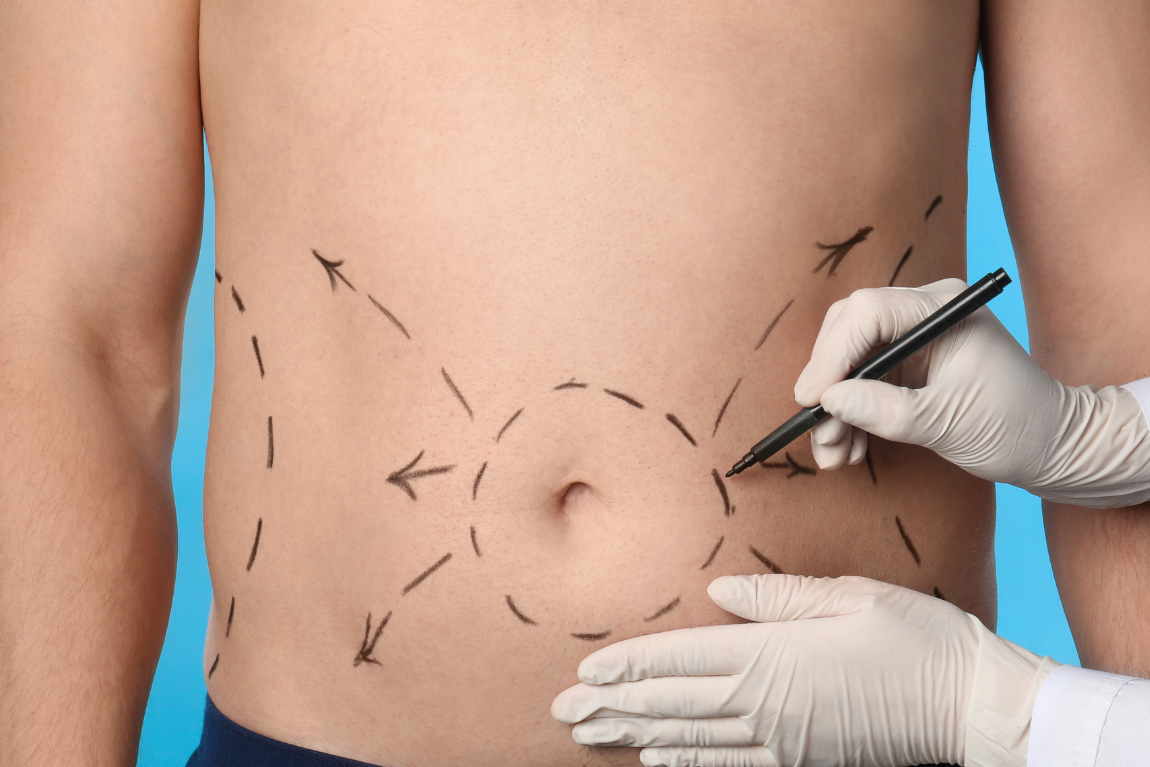 Cosmetic Surgeon Medical Malpractice